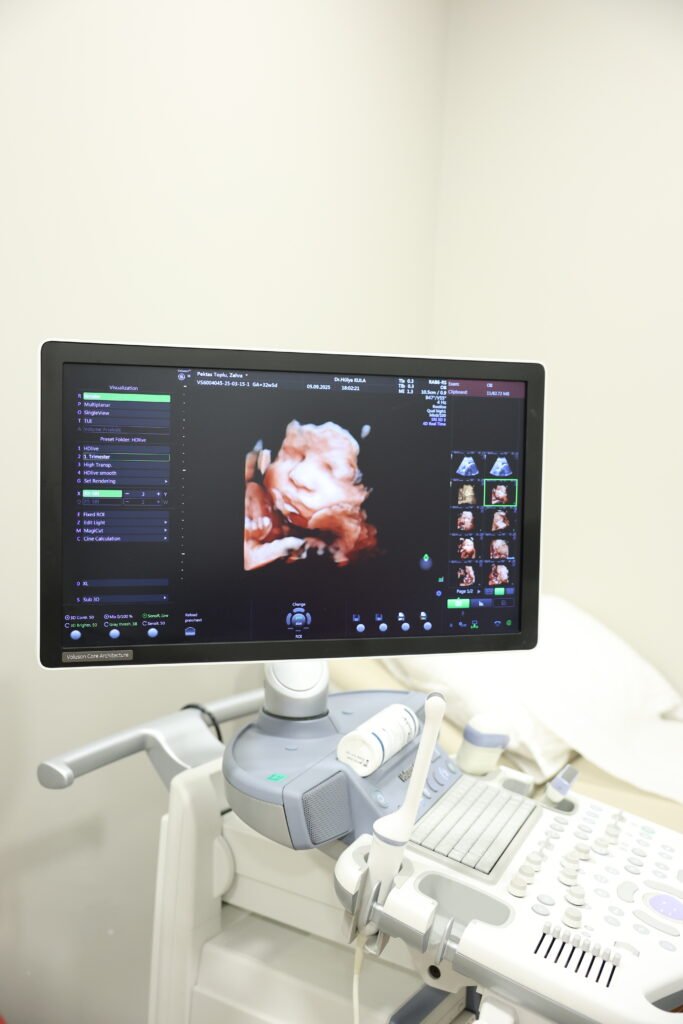 Hülya Kula Fotoğraf -39